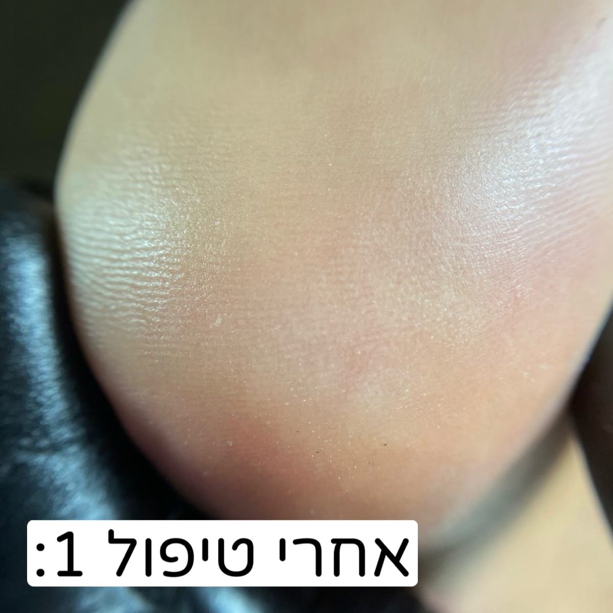 Img 0304